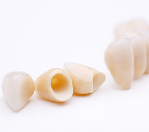 Syosset Dental Crowns and Dental Bridges