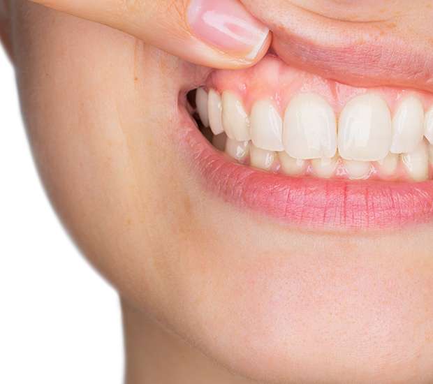 Syosset Gum Disease