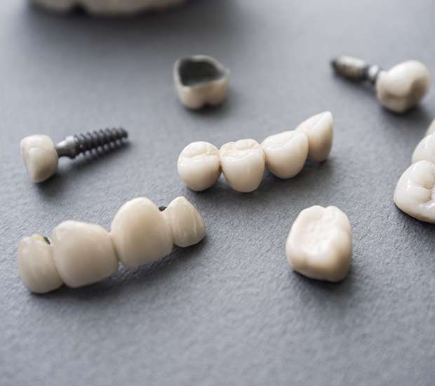 Syosset The Difference Between Dental Implants and Mini Dental Implants